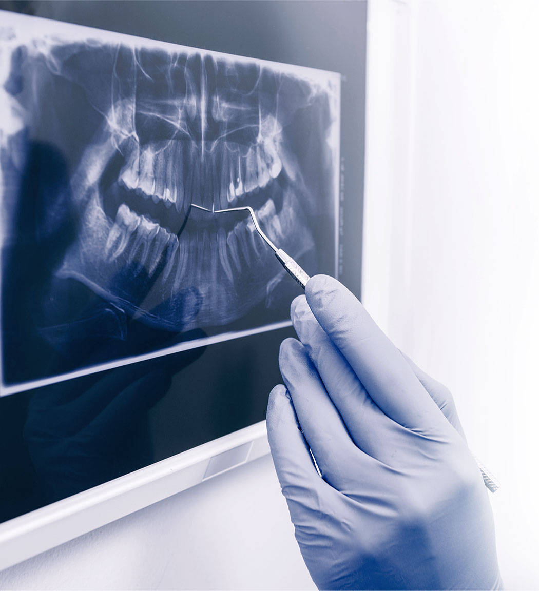 benefits-cbct-scan-image